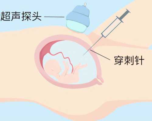供卵温州专业医院排名 在温州医院做试管婴儿如何预防腹水? ‘nt0.17看男女’